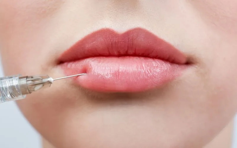 A Beginner’s Guide To Understanding Cosmetic Fillers