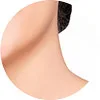 Area of Treatment for Ultherapy neck
