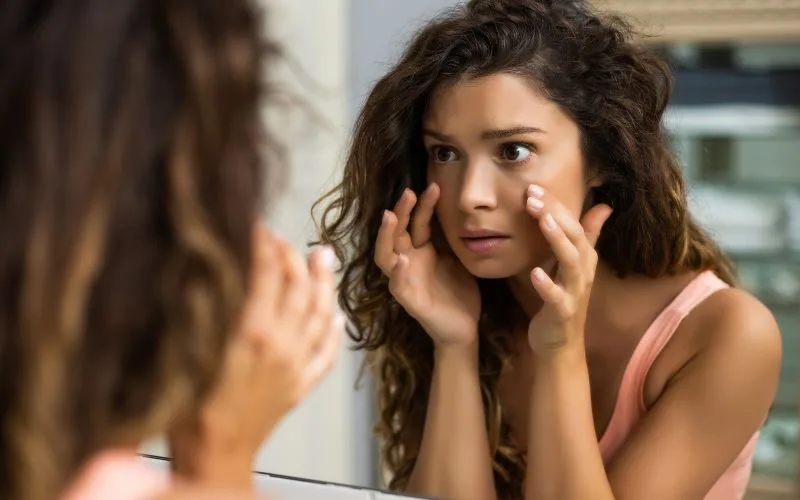 Causes of Eye Bags and skin care for baggy eyes