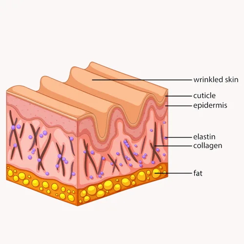 Causes of Wrinkles and Fine Lines