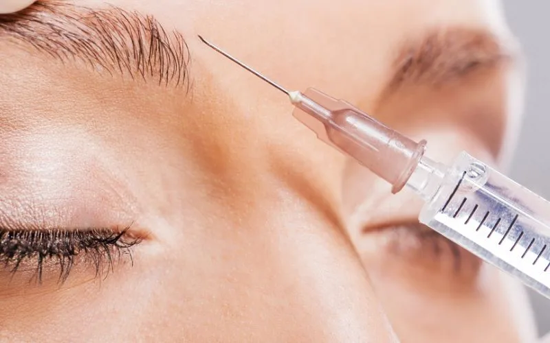 Common Areas for Botox