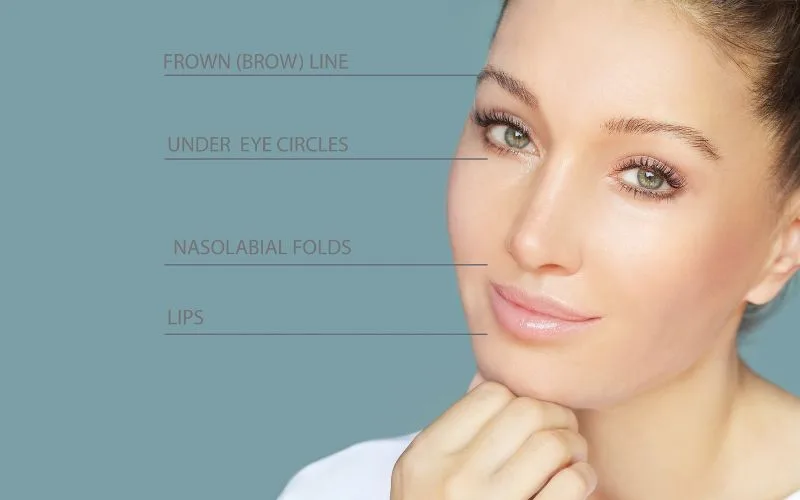 Different Areas for Cosmetic Filler Injection