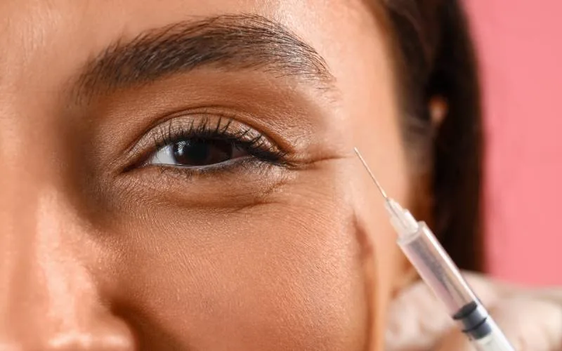 Non-Surgical Eye Bag Removal Treatment in Singapore