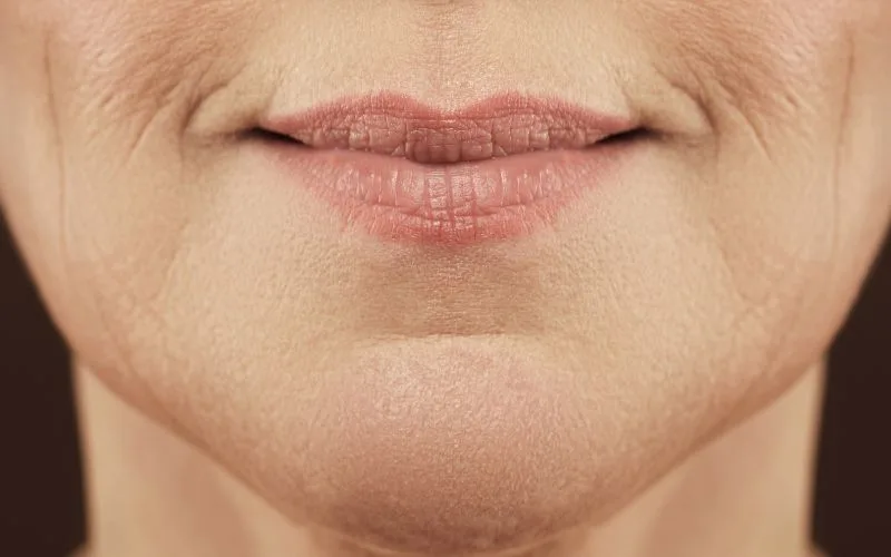 Factors Leading to Lip Ageing