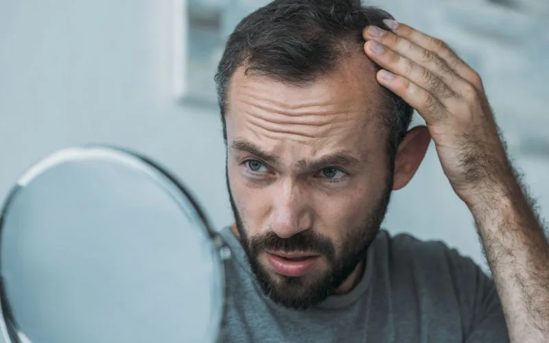 Hair Fall Myth 6 Elevated levels of testosterone are the enemy