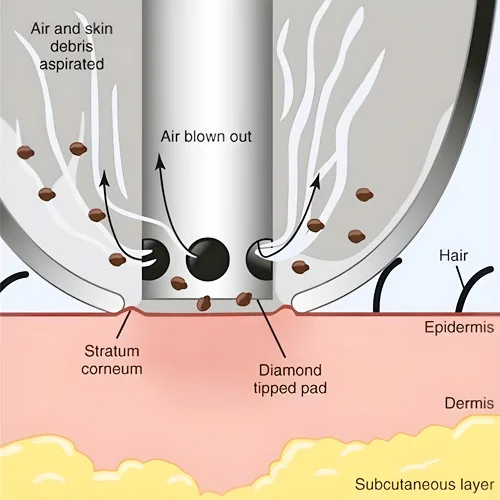 How Does Aqua Facials Work