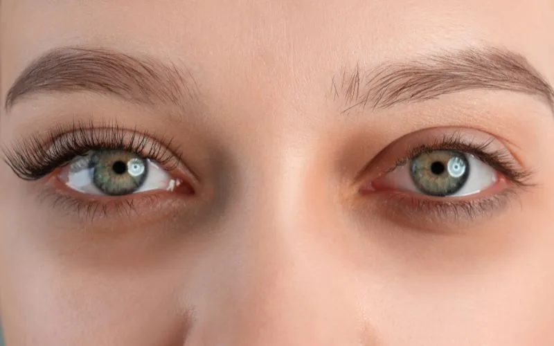 How to Remove Eye Bags Non-Surgically