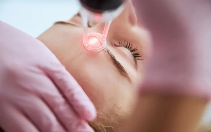 Is Picosure Laser Treatment Right For You