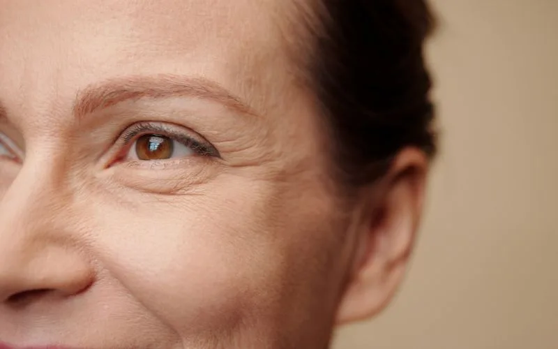 Non-Invasive Eye Bag Reduction Treatments