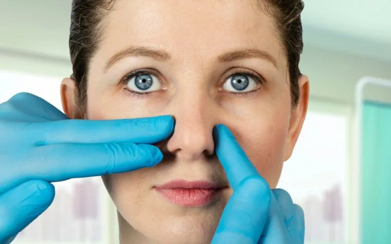 Nose Filler Treatment Process