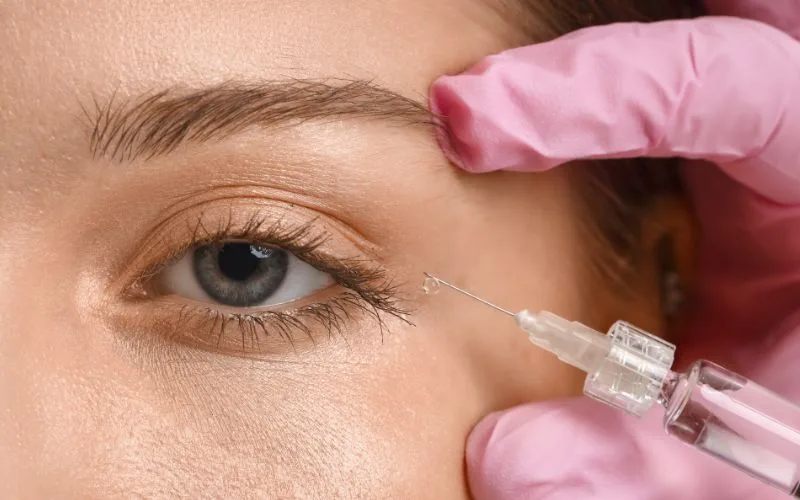 The Pros And Cons Of Ellanse Filler What Singaporeans Should Know