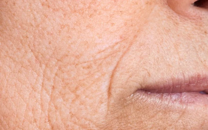 The Science Behind Wrinkles