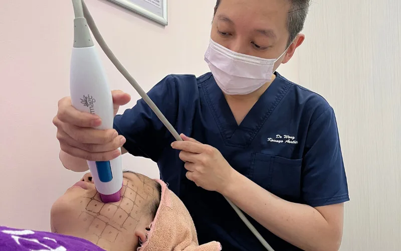 Thermage Treatment for Saggy Face