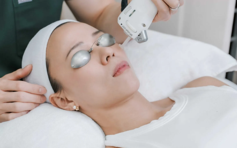 Clarity II Laser for Asian Skin