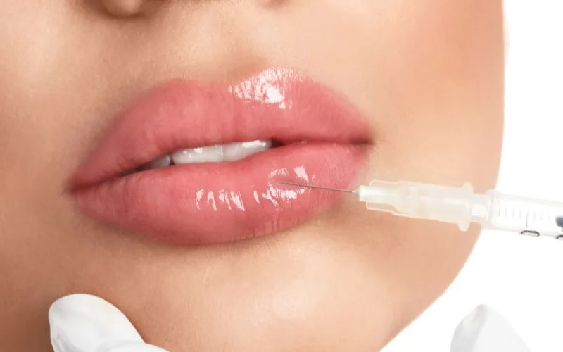 Treat Lip Ageing with Lip Fillers 