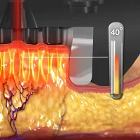 Heat Distribution