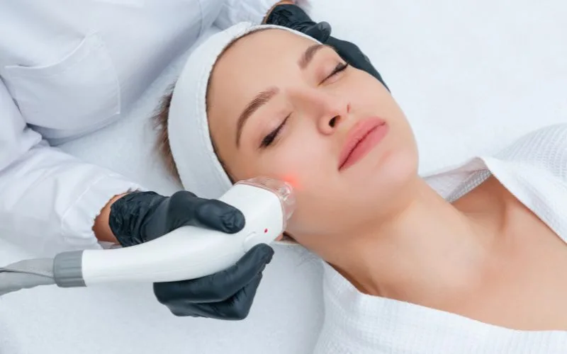 laser Reducing Fine Lines and Scarring