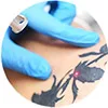 pico laser tatoo removal