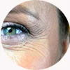 secret rf treatment for Fine lines & Wrinkles