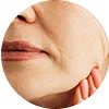 thermage tighten face skin